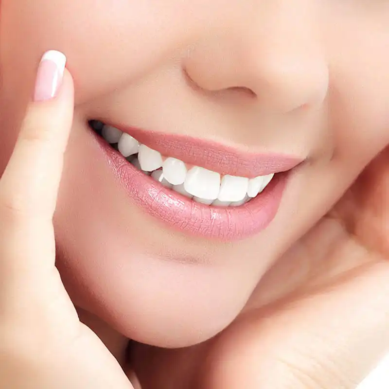 Teeth Whitening